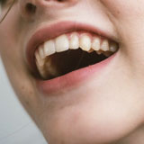 dents en argent colloïdal