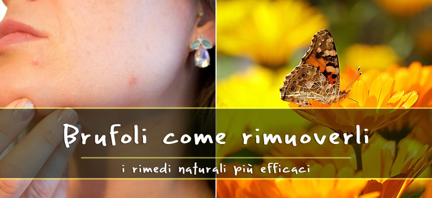 rimedi contro brufoli