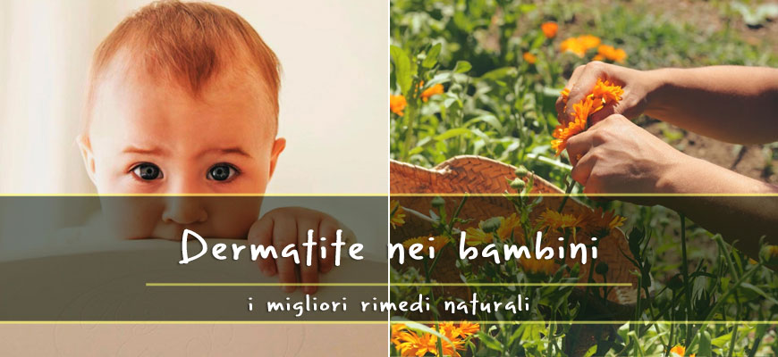 dermatiti bambini rimedi naturali