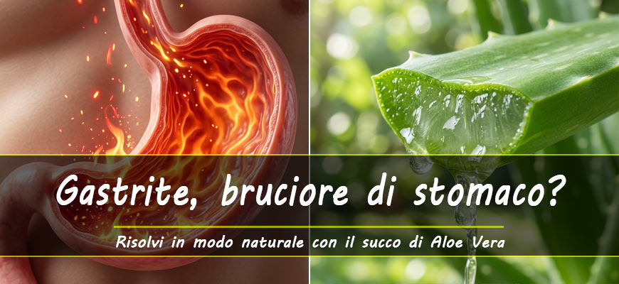 gastrite bruciore stomaco aloe vera