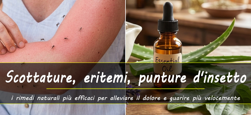 rimedi naturali scottature eritemi