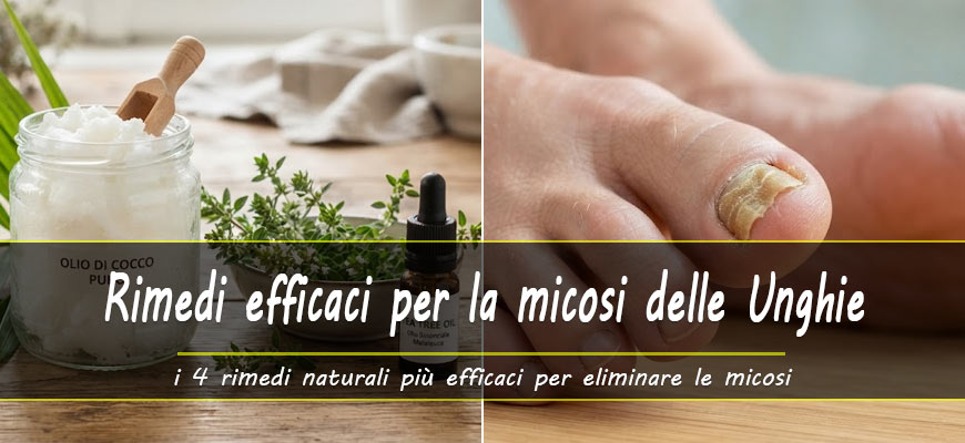 rimedi naturali micosi unghie