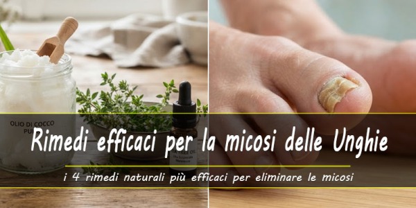4 Rimedi naturali efficaci contro le micosi delle unghie